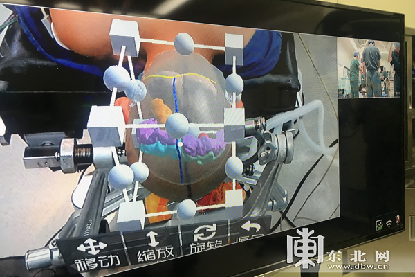 黑龙江省首例5G＋MR技术辅助神经外科手术完成